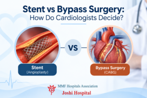 Cardiologist explaining stent vs bypass surgery to patient
